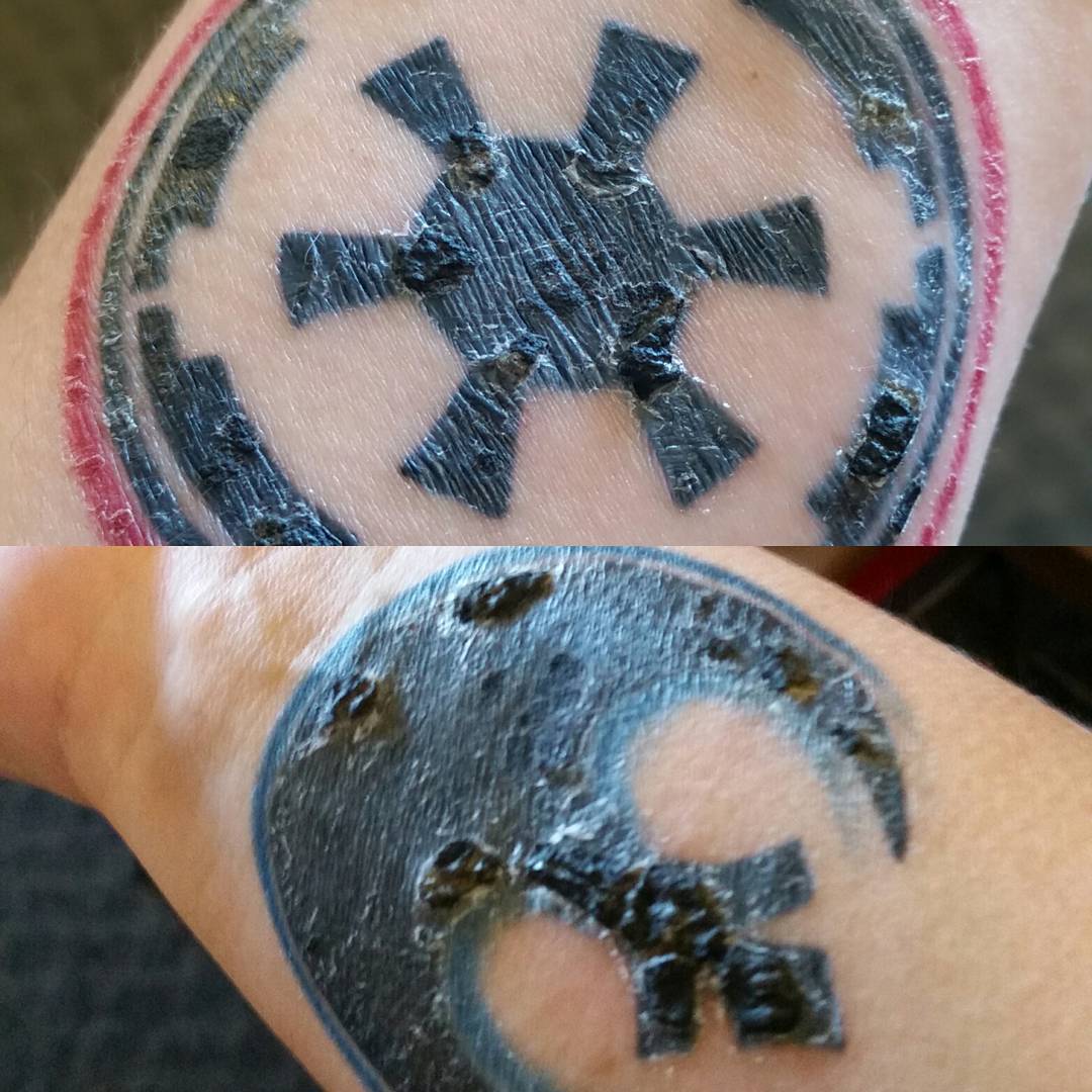 What to Do When Tattoo Is Peeling and the Ink Is Coming Off Before and  After   Saved Tattoo