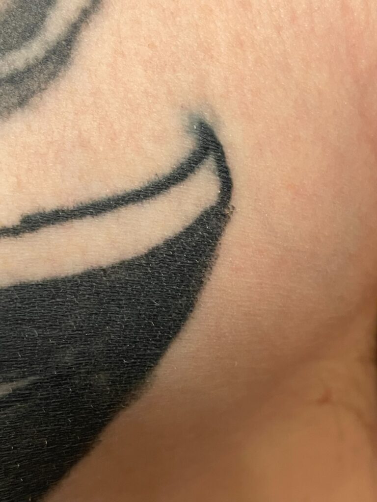 How Do I Know if My Tattoo is Infected  Stories and Ink