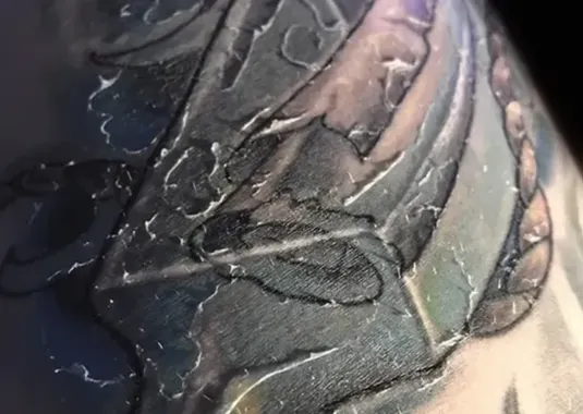 Normal tattoo peeling